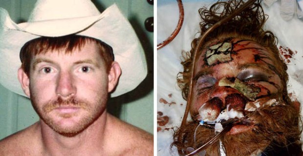 Before and after the beating