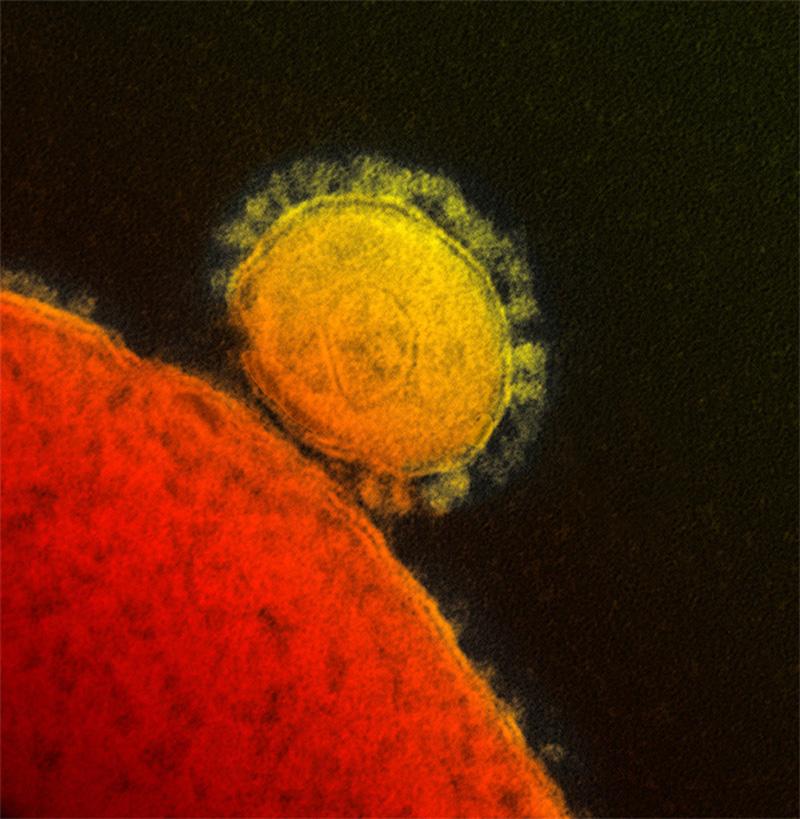 For Your Health: MERS-CoV, Todays Emerging Virus