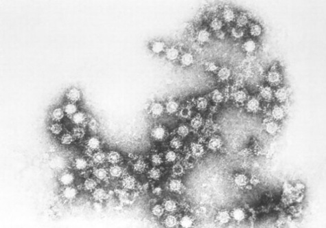 01WEB_Enterovirus100814_750_14004426_8col