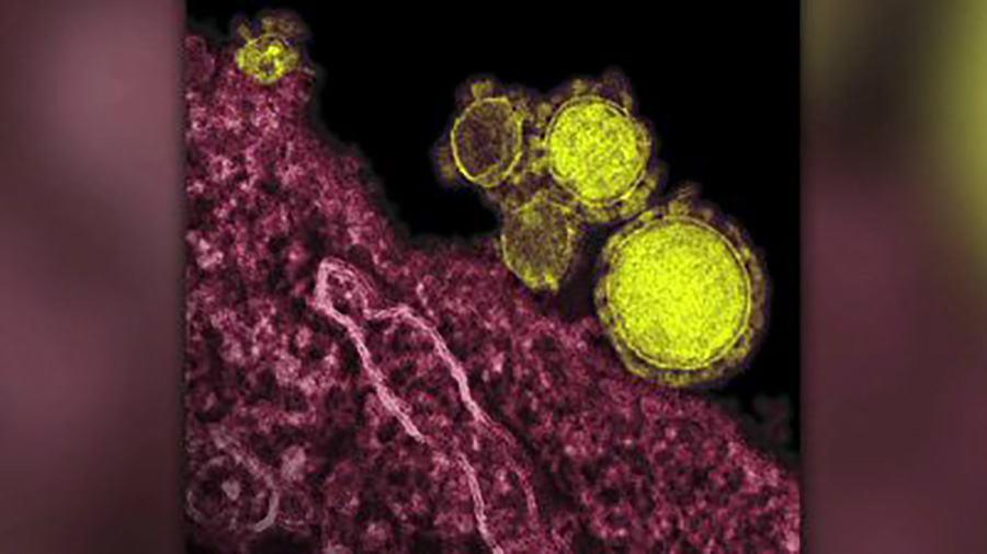For+Your+Health%3A+the+steady+rise+of+Enterovirus+in+the+United+States