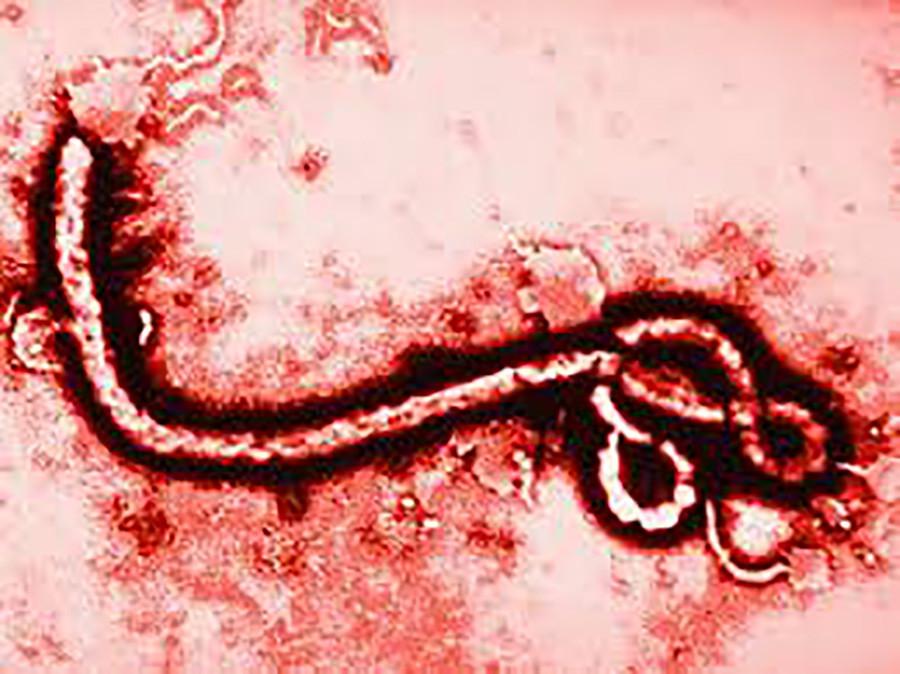For Your Health: Ebola Q and A